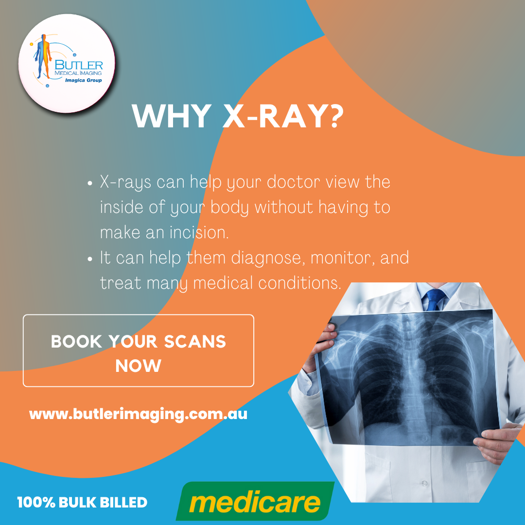 XRay Services at Butler Medical Imaging.(08) 9544 3999 Crystalradiology Aus Medium