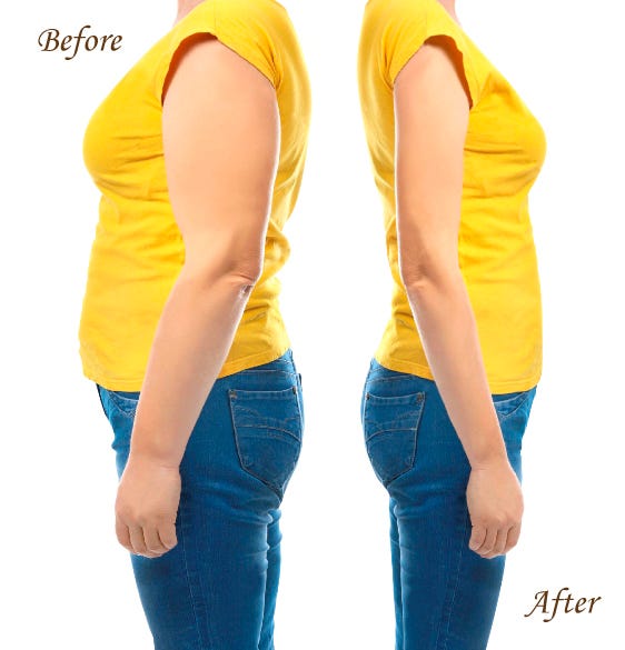 A brief overview tummytuck surgery by 365mc Hospital Medium