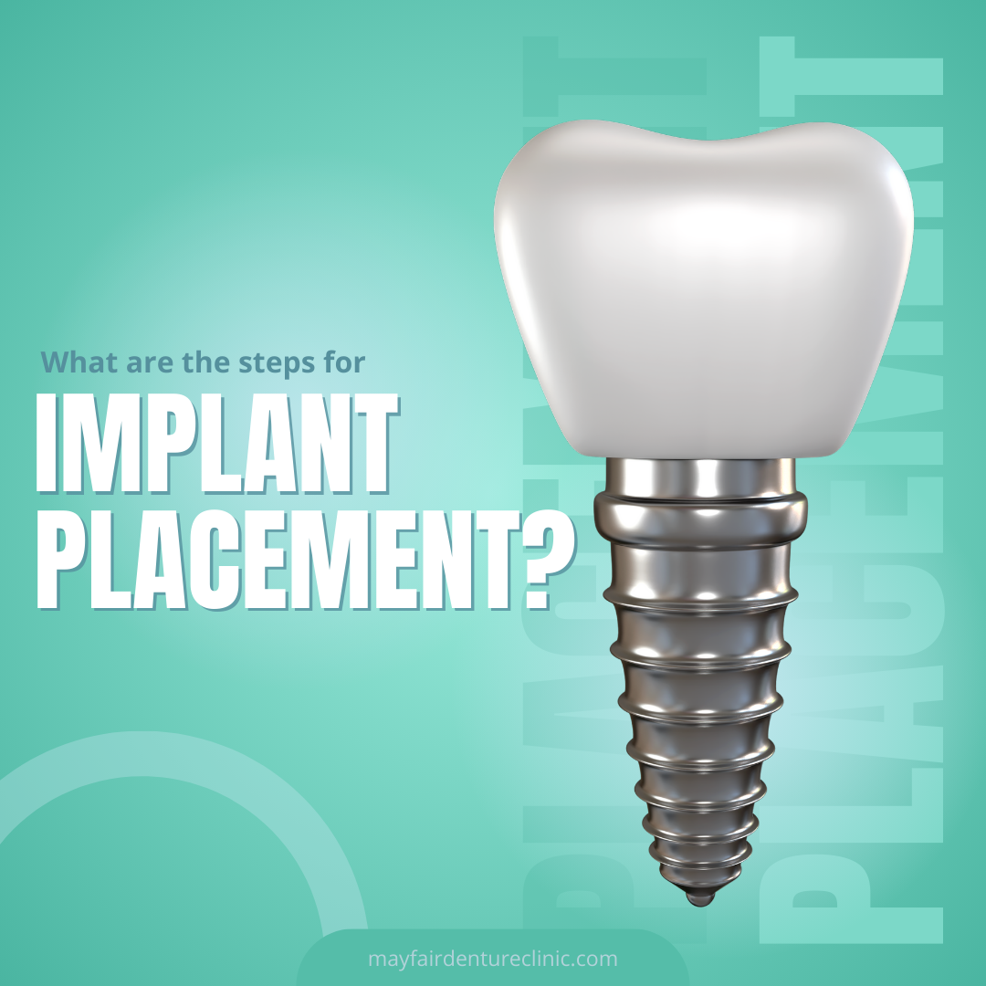 Discover the Best Denture Clinics in Calgary by Bob Jul, 2024 Medium