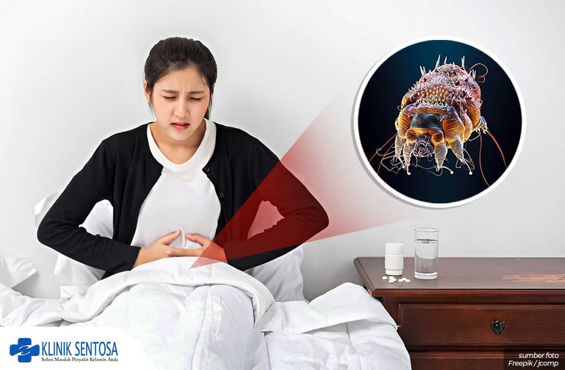 Ada Benjolan di Pinggir Kemaluan Wanita? 5 Penyakit Ini Penyebabnya