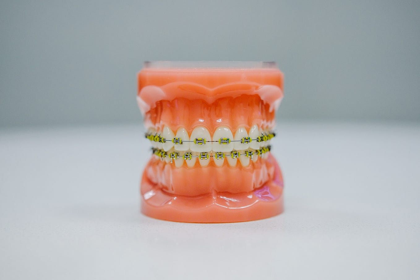 How Mouthpiece For Braces Are Essential? by Amazing Smiles