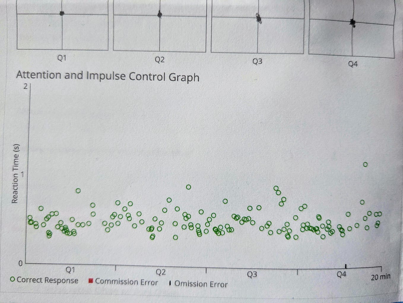 The Challenge of Settling My Itchy AuDHD Mind Why Can’t I Just Do It