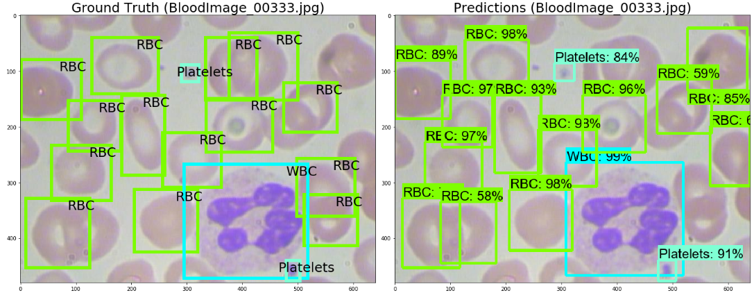 Deep Learning with Python: Epileptic Seizure Detection on EEG | by ...