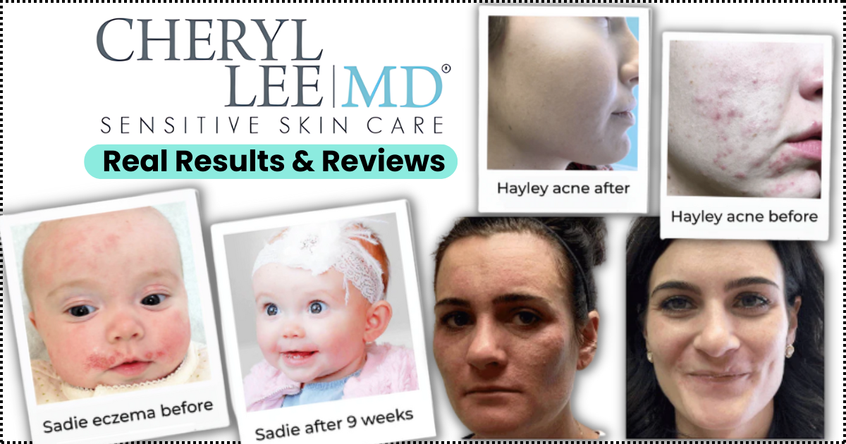 VARON Oxygen Concentrator Review (2024) A Comprehensive Guide by Adam Steel Medium