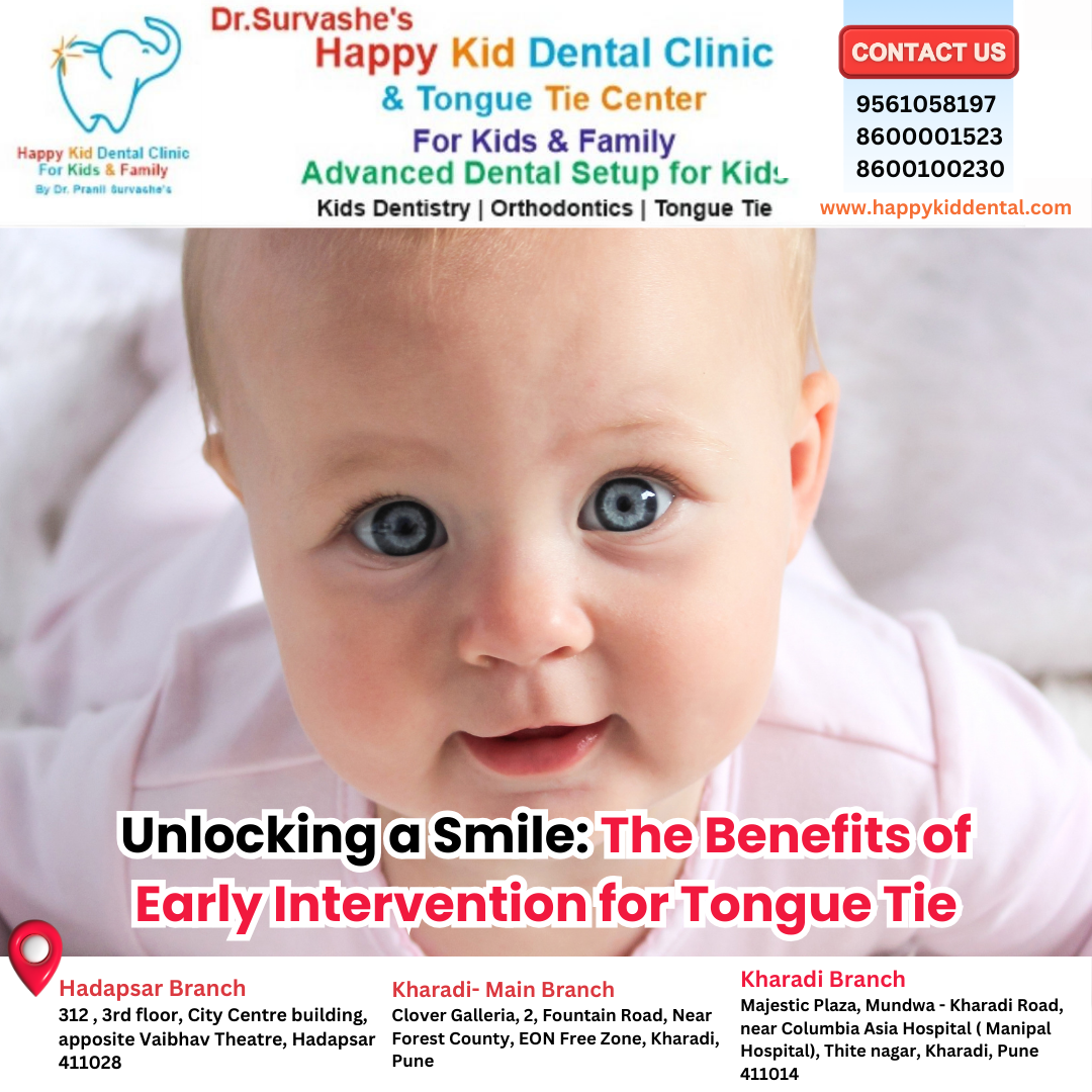 How to Recognize Signs of Tongue Tie in Infants Essential Guide by