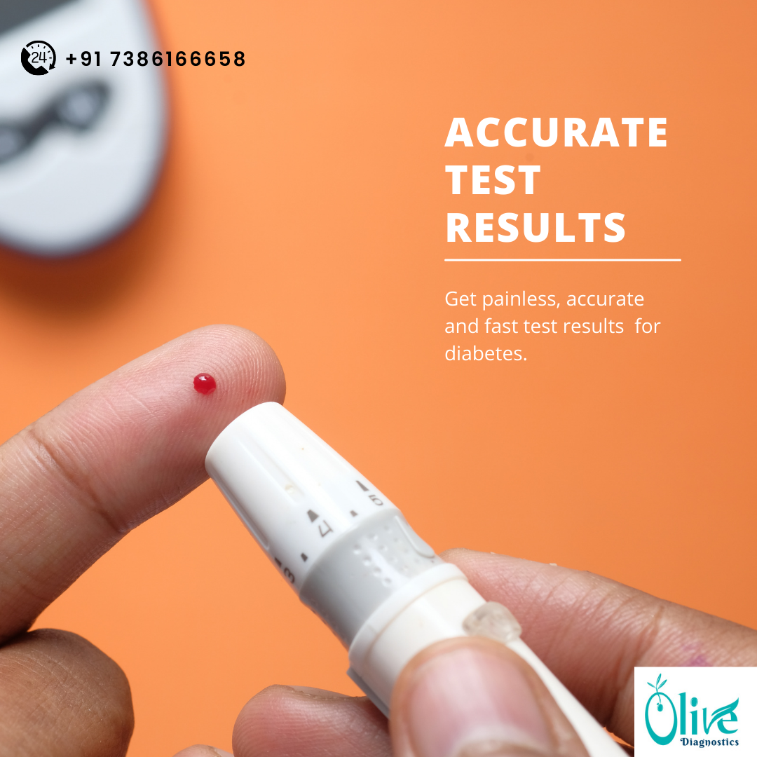 Olive Diagnostic Centre in Bhimavaram Olive diagnostics Medium