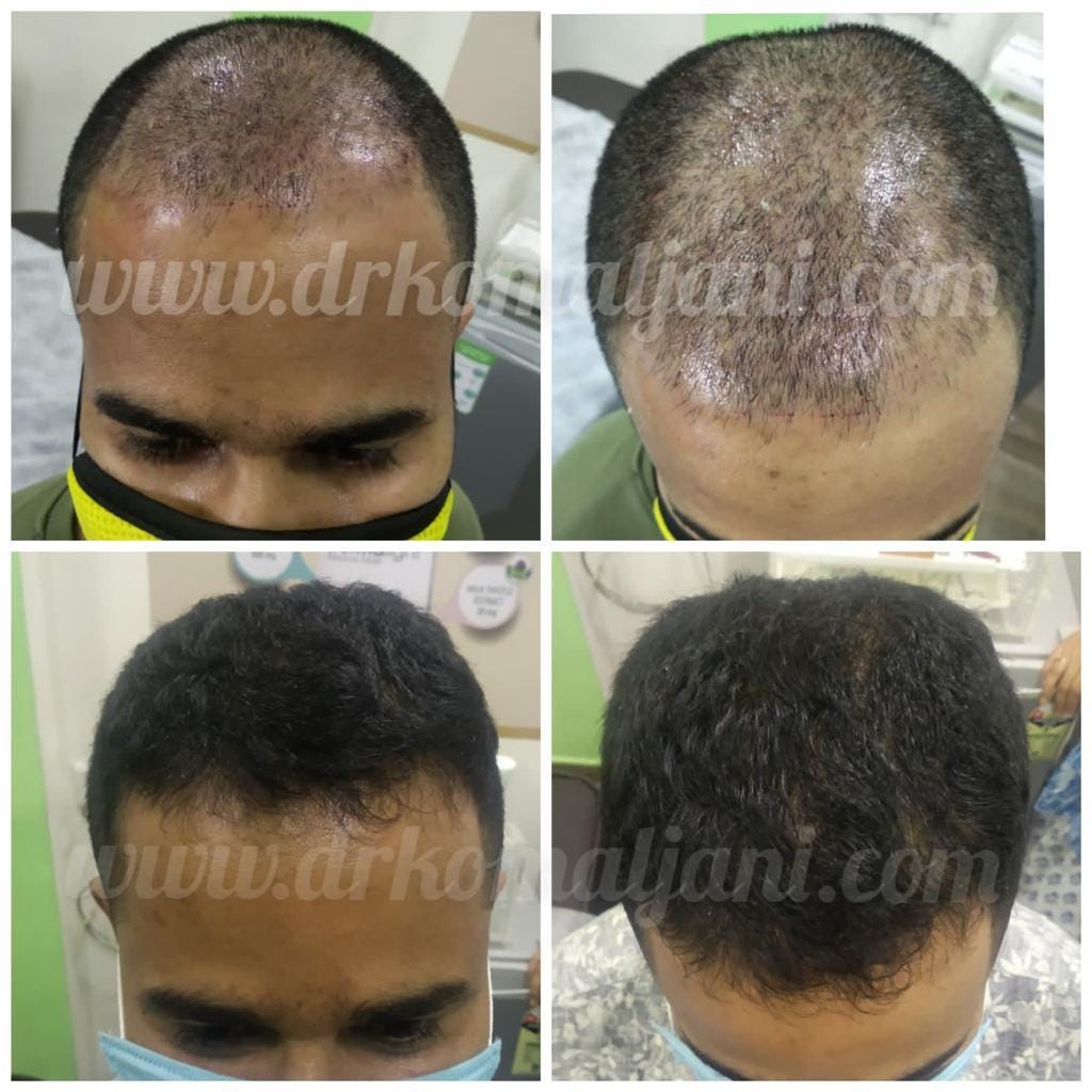 Best Skin Specialist in Ghatkopar Dr. Komaljani’s Expertise in