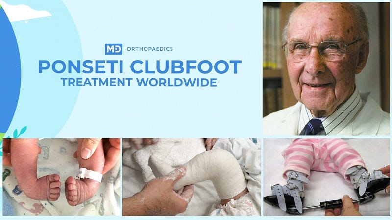 How to Treat Clubfoot in Babies - Thomas Sharp - Medium