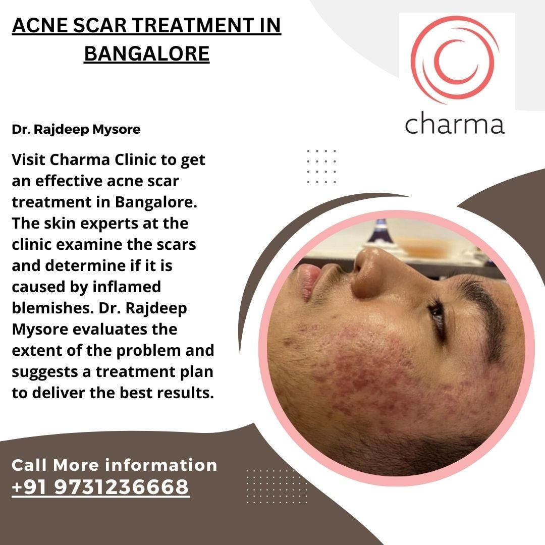 Best Dermatologist in Bangalore — Charma Clinic Charma Clinic Medium