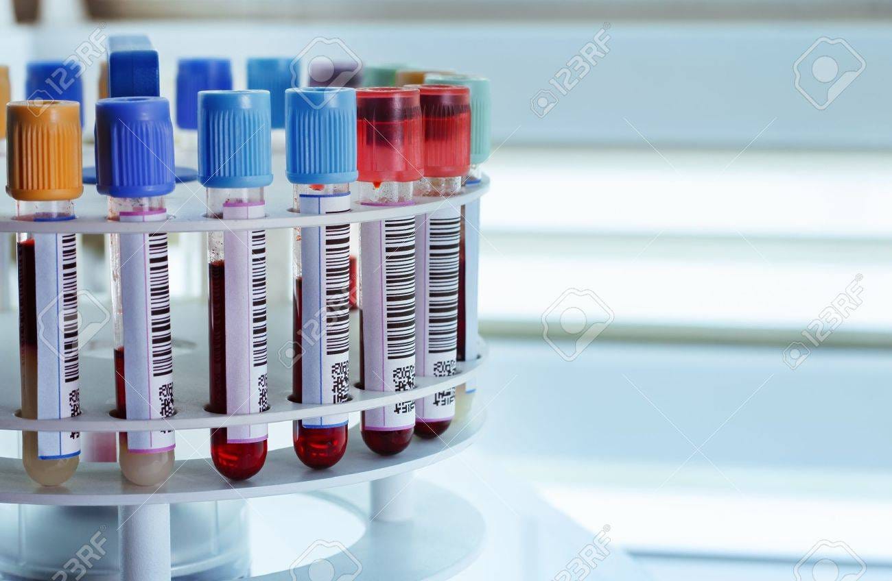 How Do You Centrifuge A Blood Sample? Blood Bank Depot Medium