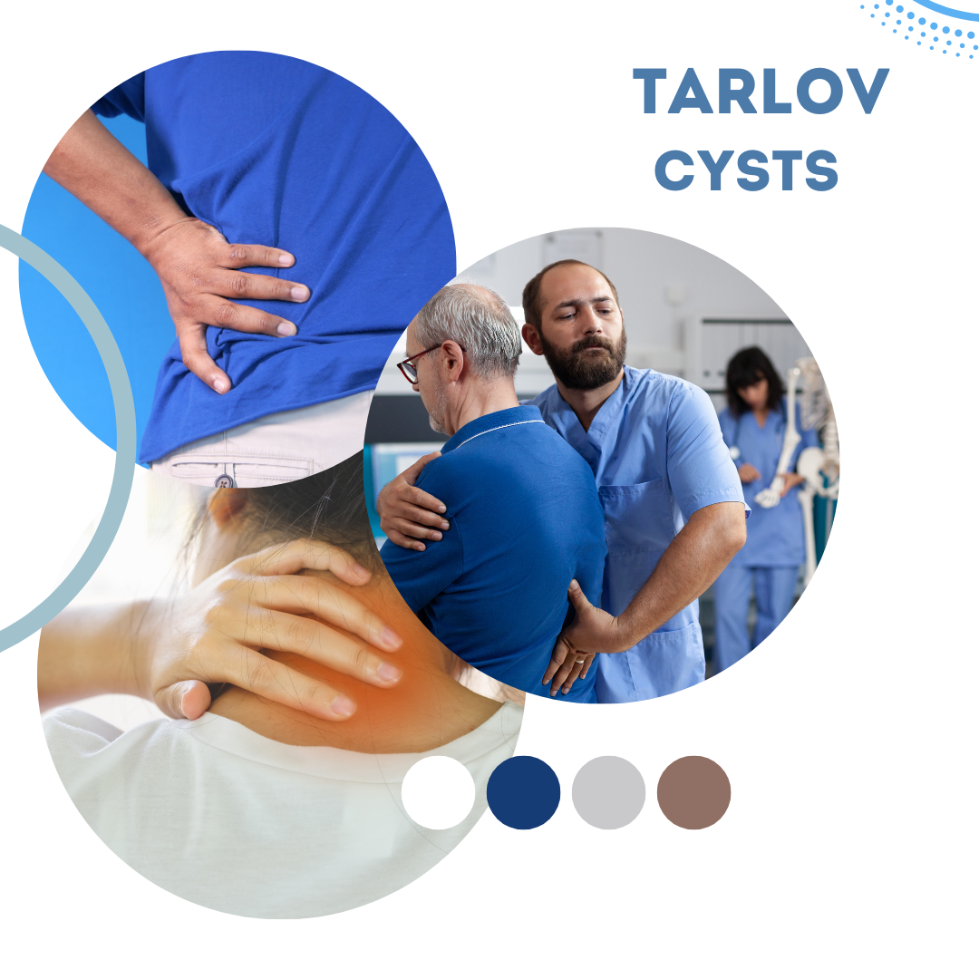 Exercises to Avoid with Tarlov Cysts Safe Activity Tips