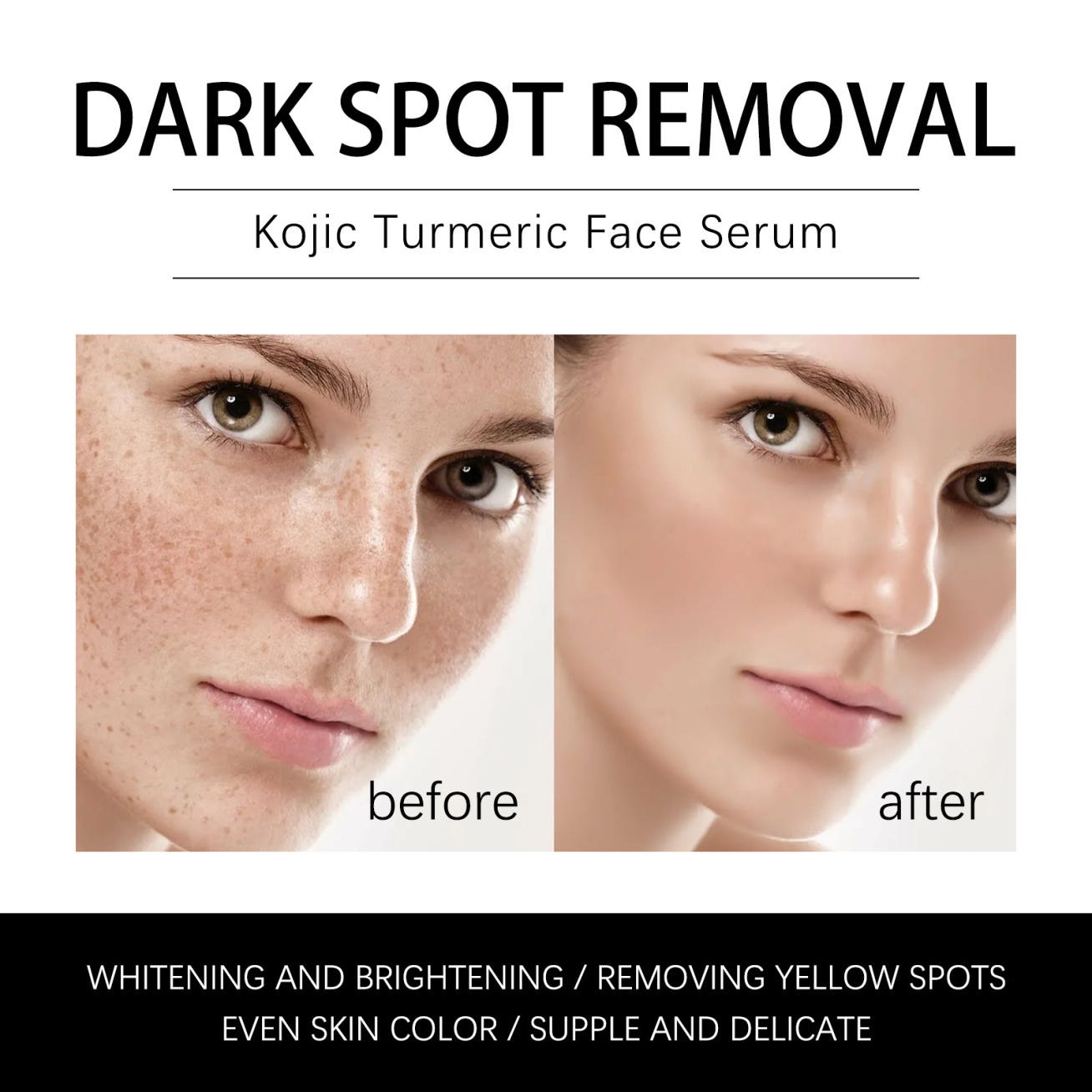 Turmeric Serum, Dark Spot Remover, Glowing Flawless Skin, Dark Spot  Corrector 