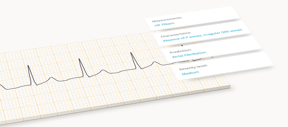 Lessons from CardioLogs, the French AI Startup disrupting Cardiology: from Data Acquisition to…