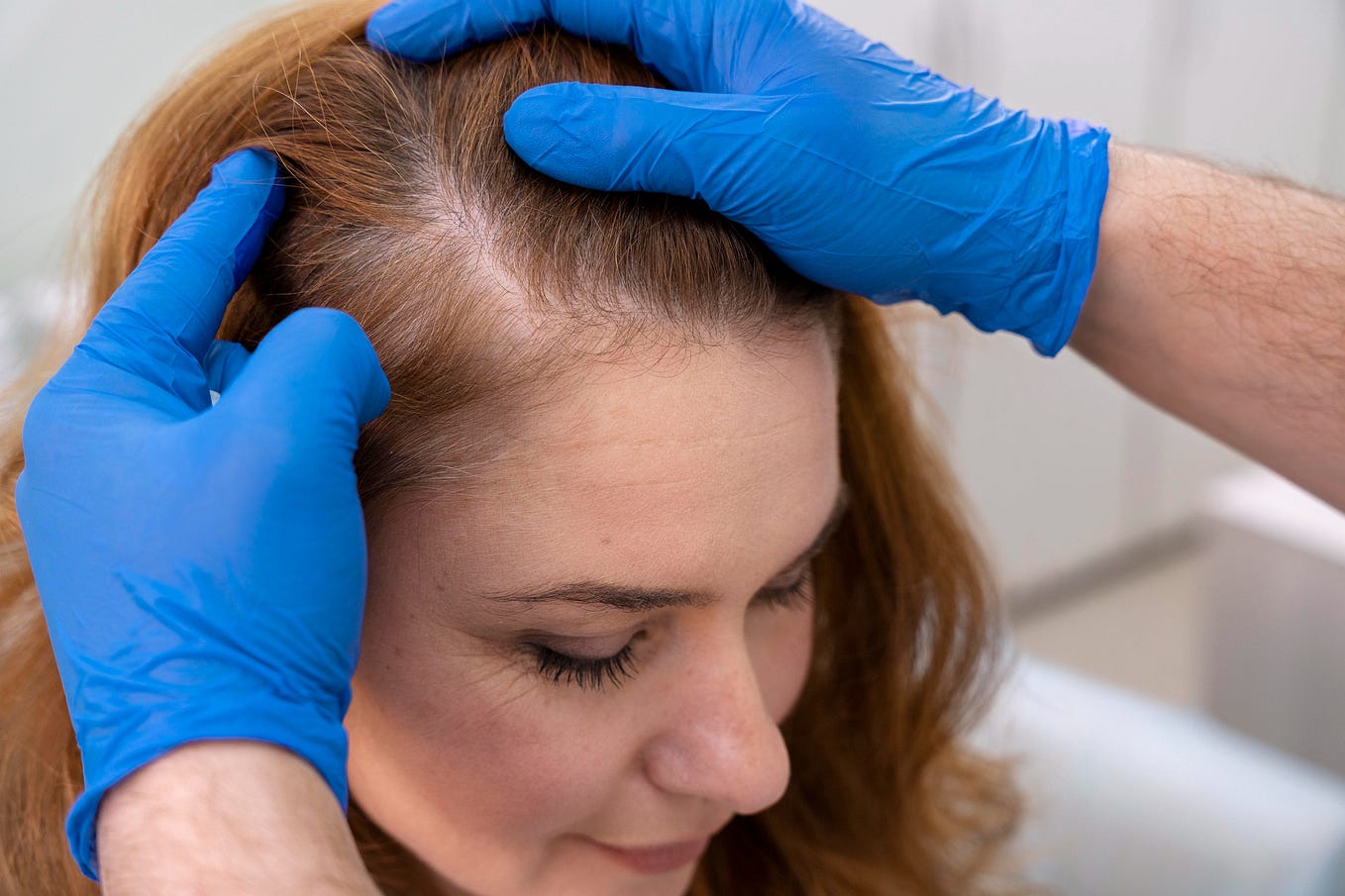 Best Hair Transplant Evolved Hair Restoration Medium