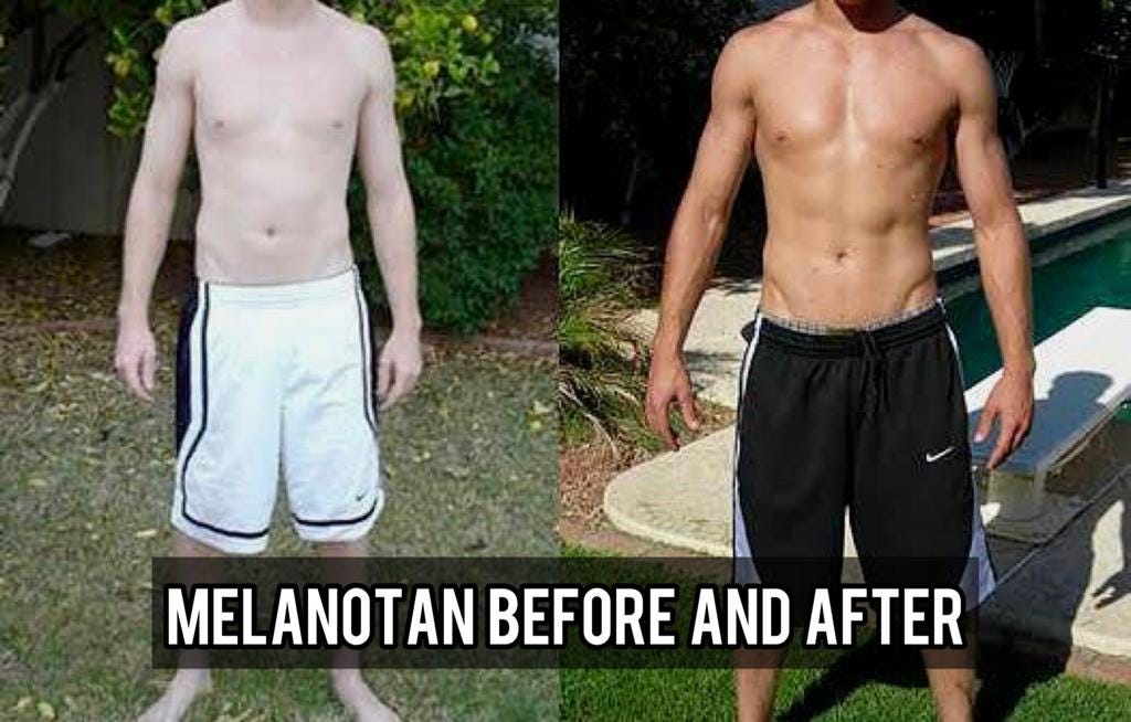 **Exploring Melanotan: The Science, Benefits, and Controversies** | by ...