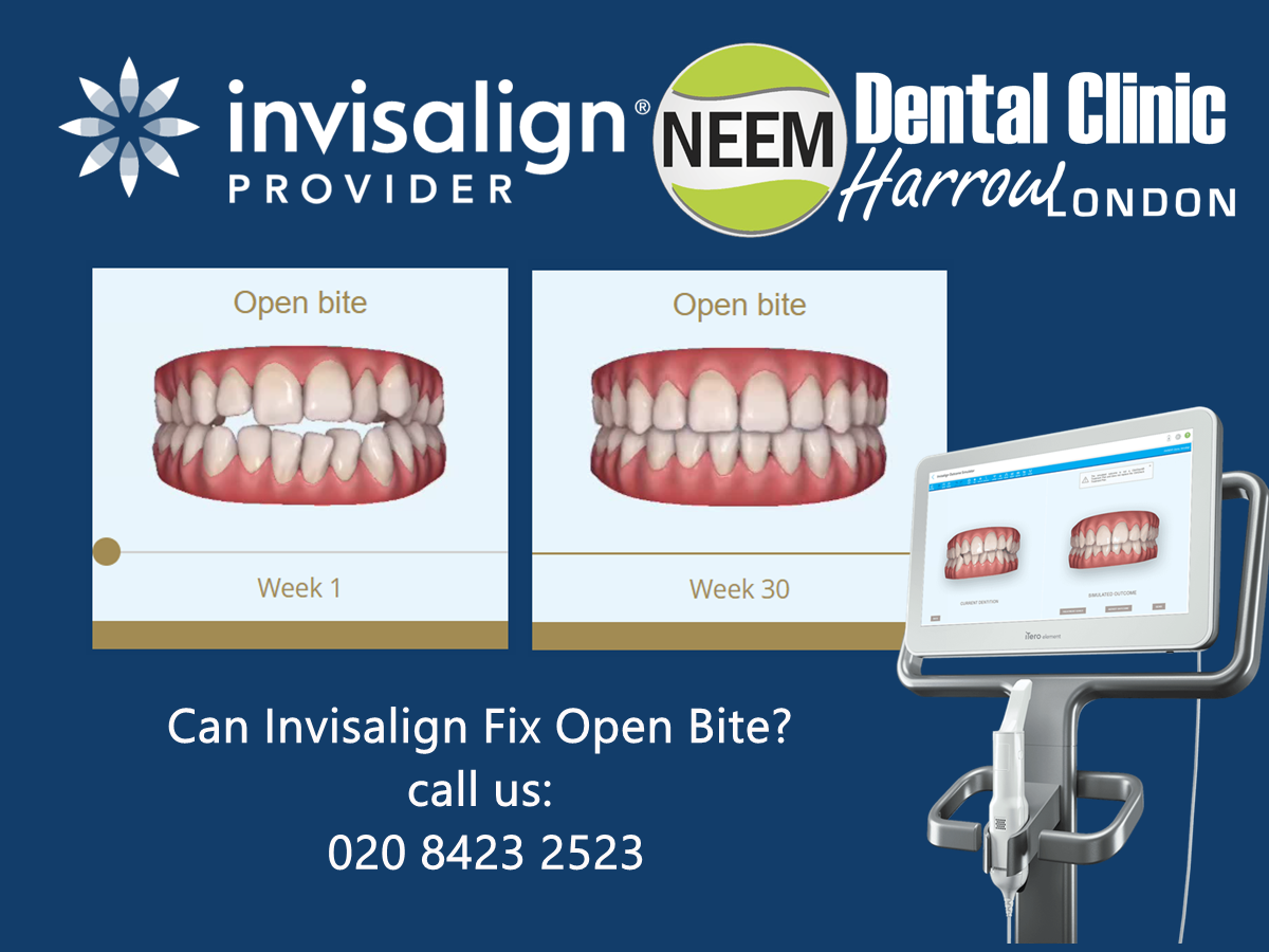The cost of dental implants Neem Dental Clinic Harrow Wembley