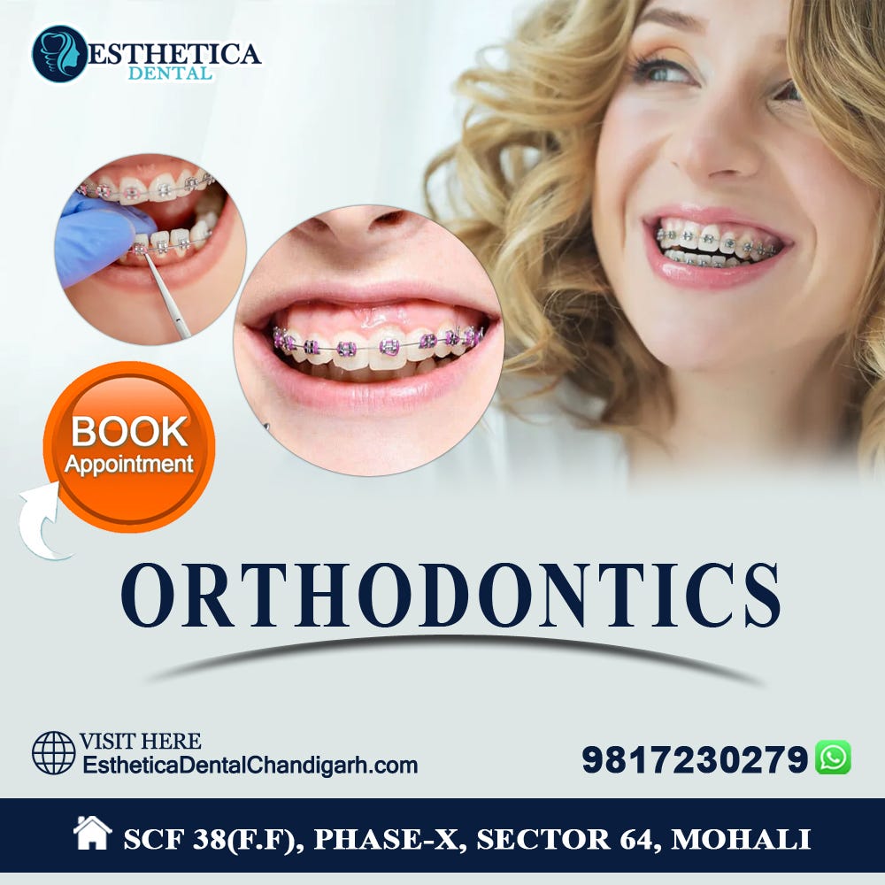 Revive Your Smile with Flawless Dental Implants at Esthetica Dental