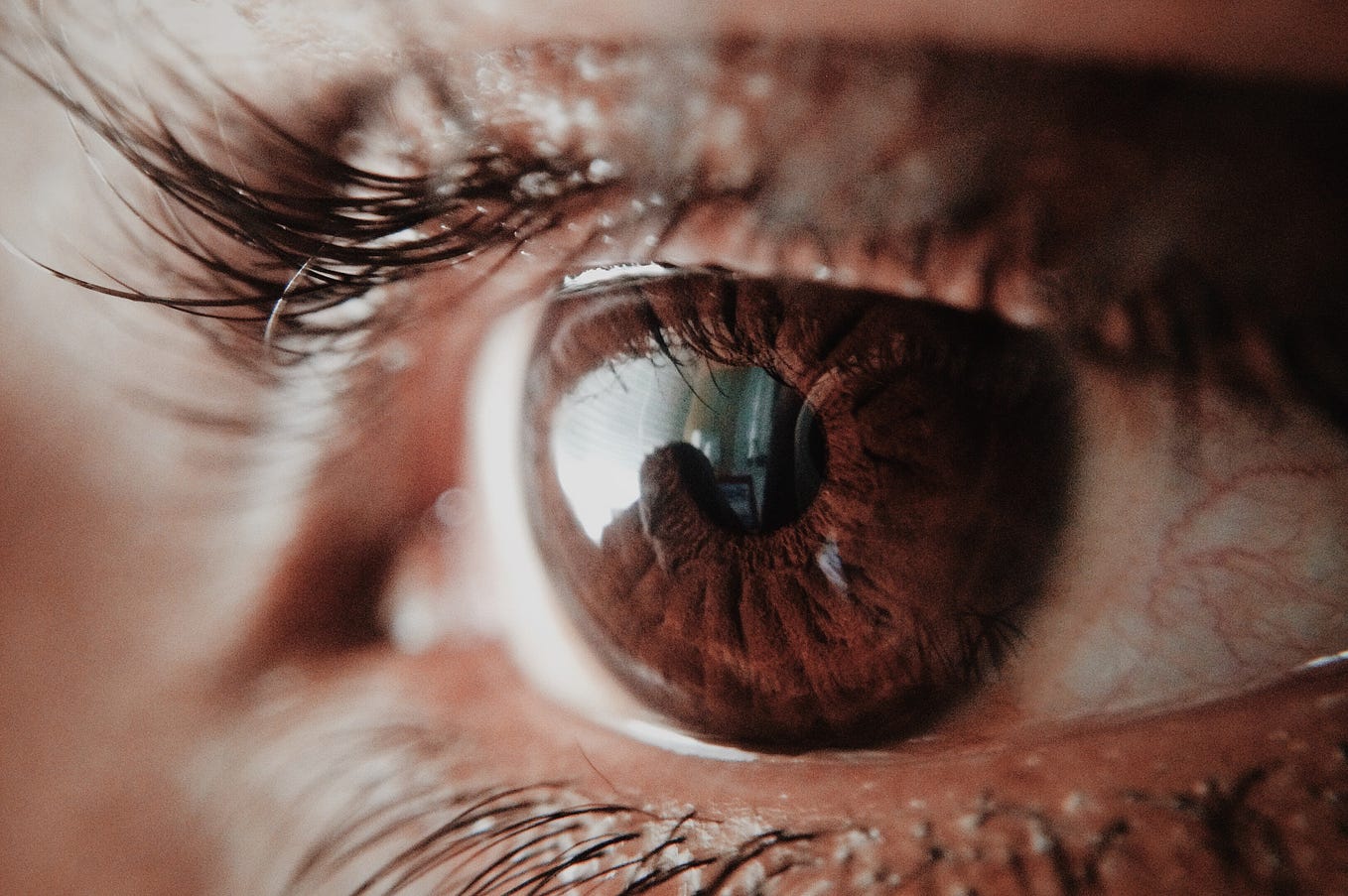 What Is Wet AgeRelated Macular Degeneration? by Quinton Oswald Medium