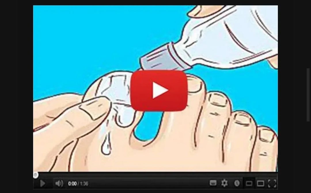 After running hundreds of tests on people with foot fungus... They discovered that the infection