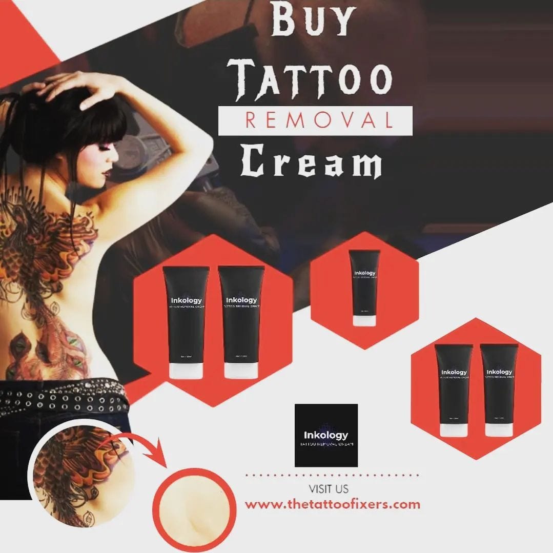Tattoo Removal Cream The Tattoo Fixers Medium