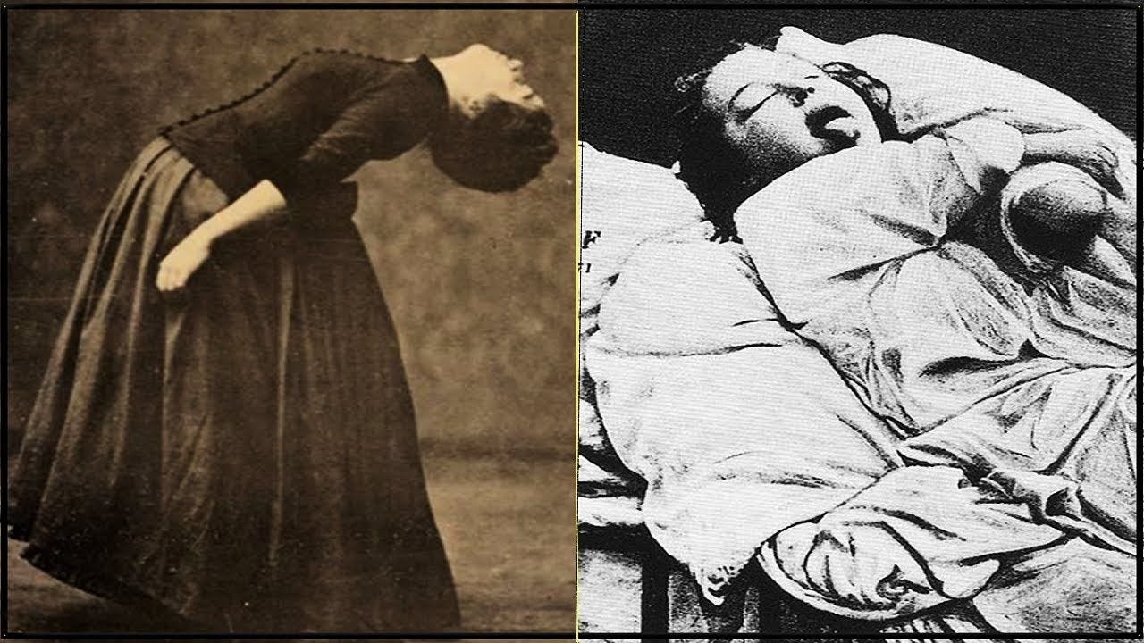 бешеный женщины матки бешеный