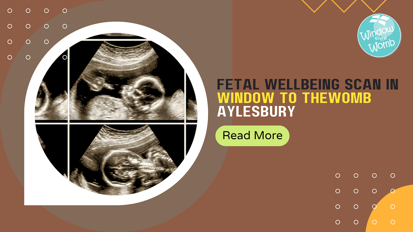 What to Know About a 4D Baby Scan? by Aylesbury Baby Scan Clinic