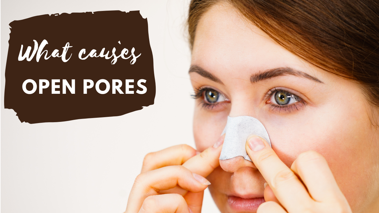 Open pores: can you close them?Dermatologist reveals the truth | by Dr  Surbhi Mahajan | Medium