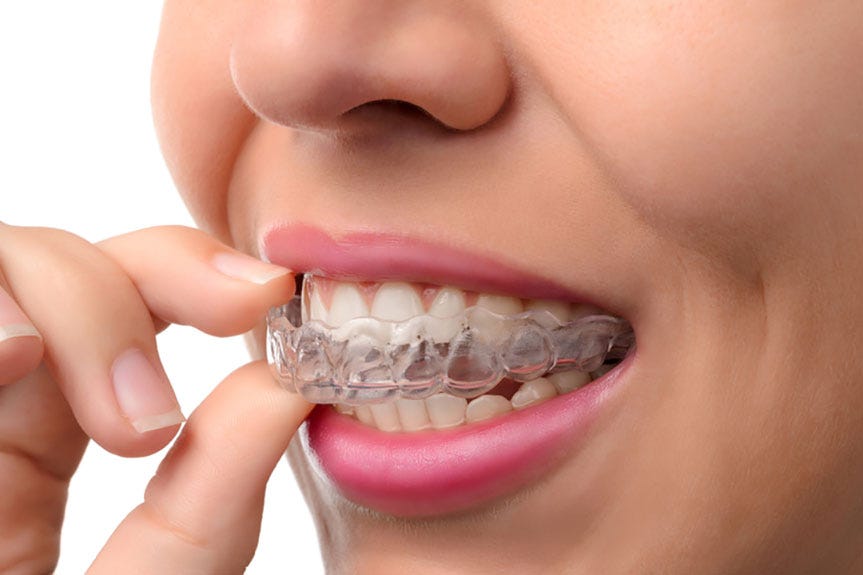 How Long Does It Take to See Results with Invisalign Braces by