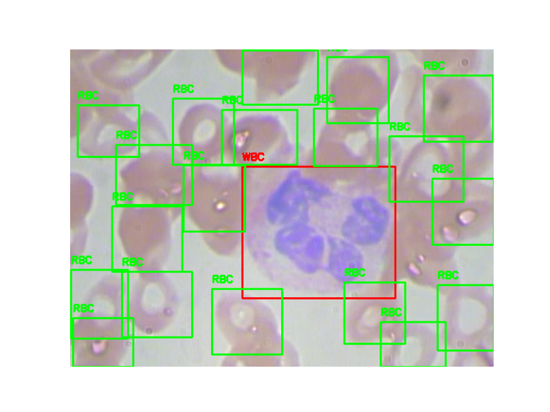 Introduction to Image Processing with Python | by Erika Lacson | Towards AI