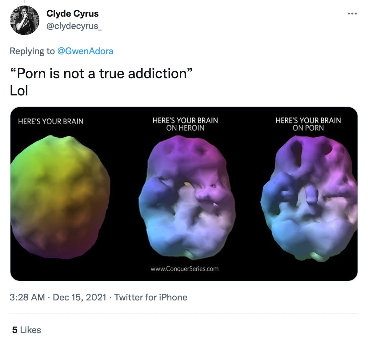 "Your Brain On Porn (YBOP). A classic. One of the best references to