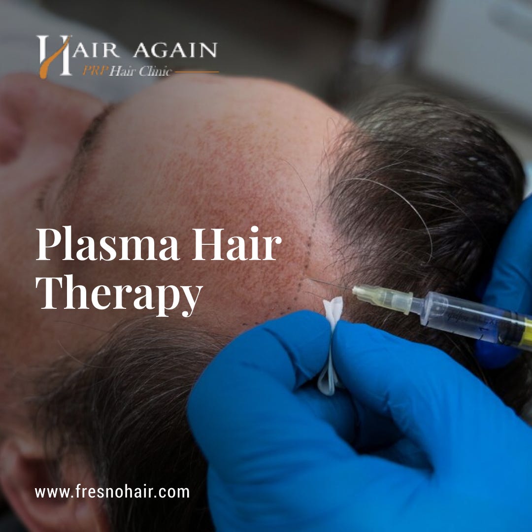 The Future of Hair Loss Treatment: PRP Therapy in Fresno | by