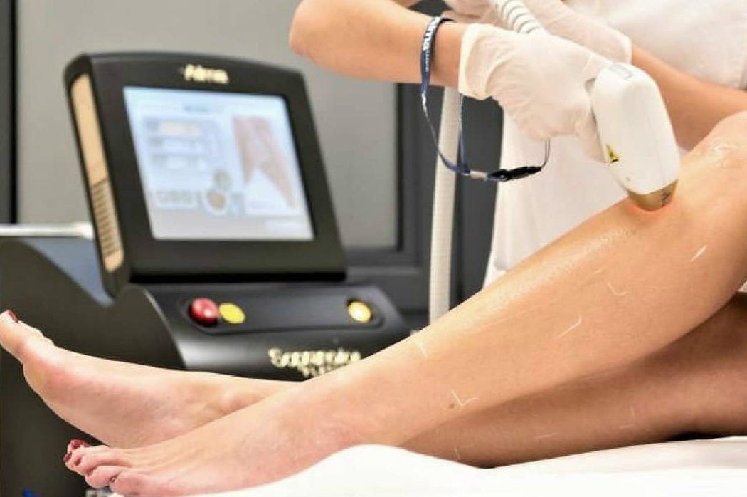 7 arsye pse duhet të zgjidhni depilimin me laser