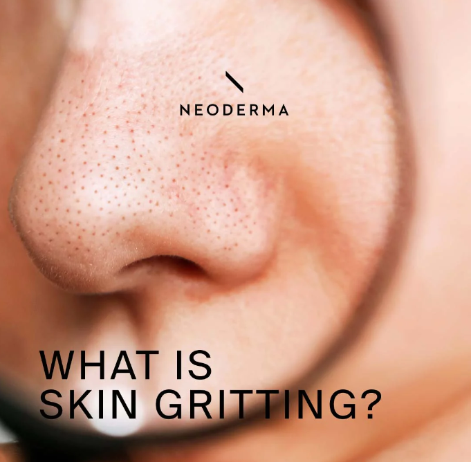 Pimple Inside Nose | NEODERMA. Are you looking for a cure for pimples ...