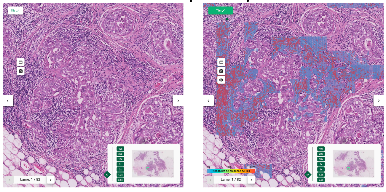 Aided-Diagnosis in Dermatopathology: Automatic Detection and Measure of ...
