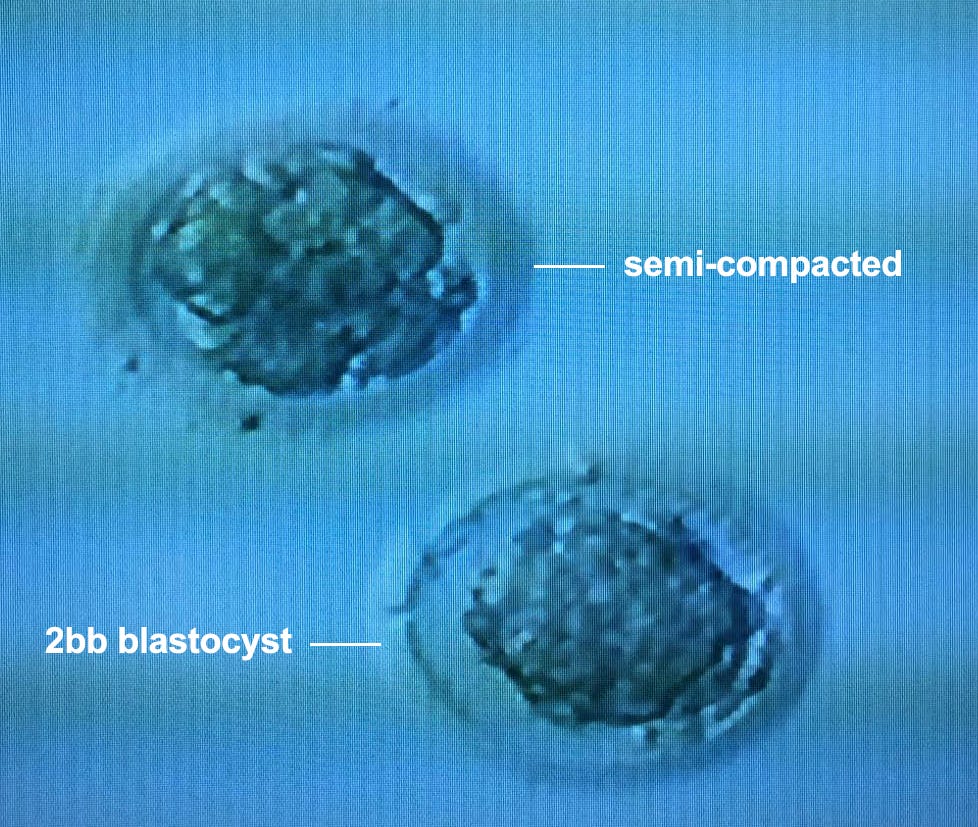 Strike 2. It didn’t work. I to update and… by Frozen Embryos
