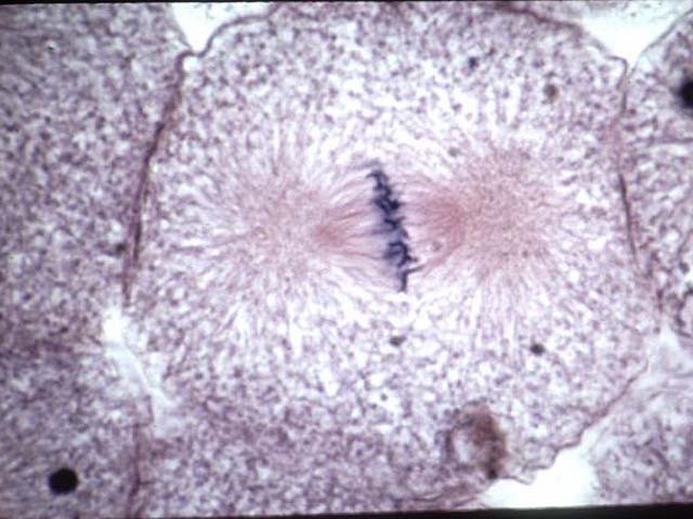 Метафаза лука в микроскоп. Анафаза в клетке лука. Анафаза митоза микроскоп. Метафаза в микроскопе. Анафаза микрофотография.
