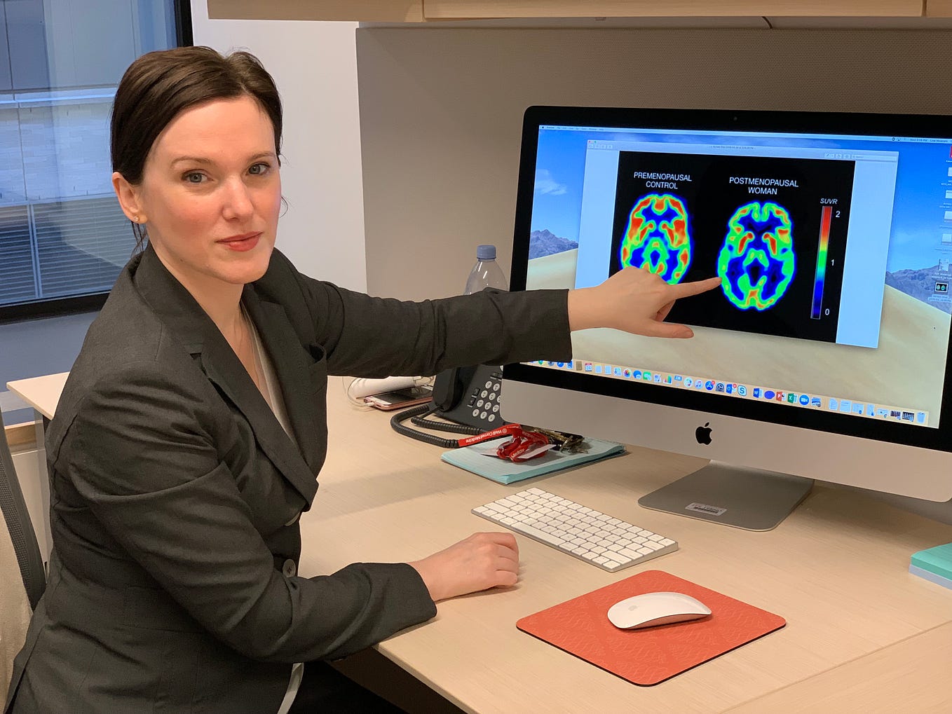 Exploring the Link Between Menopause and Alzheimer’s