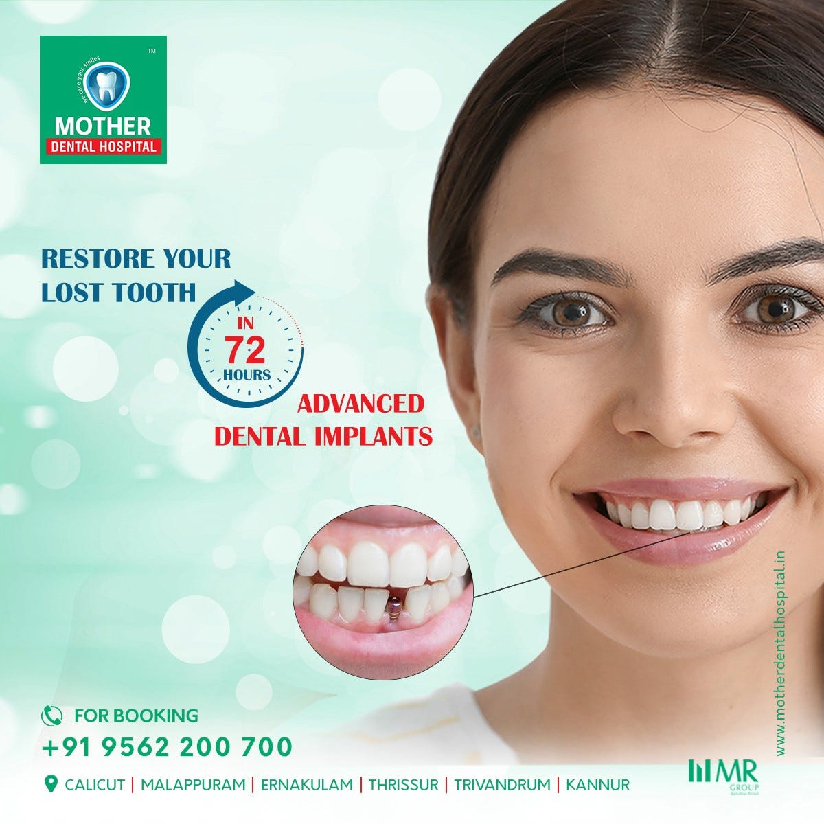 Best Dental Clinic in Kerala - Motherdental - Medium