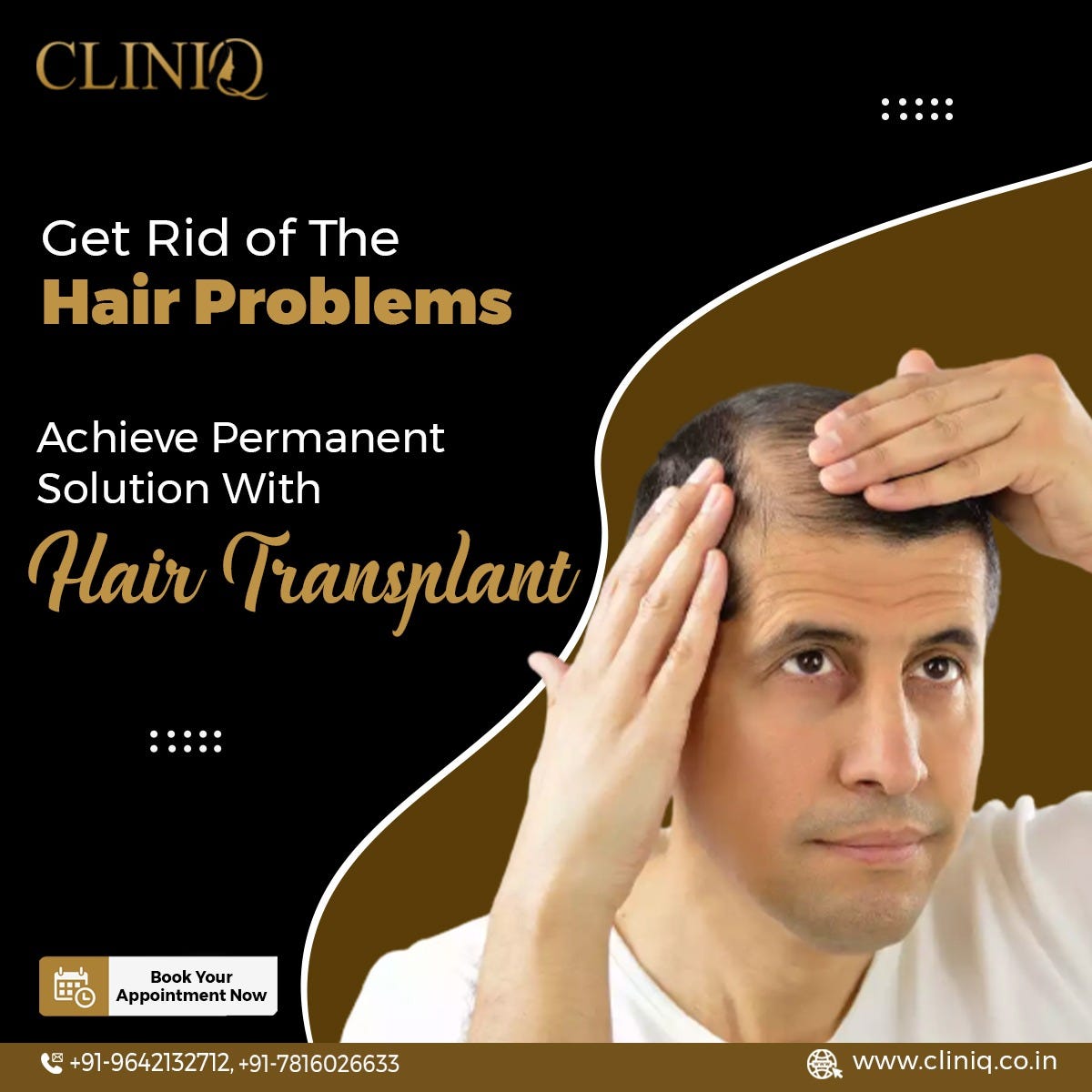 Best Hair Transplant Clinic In Hyderabad by Kdm Medium