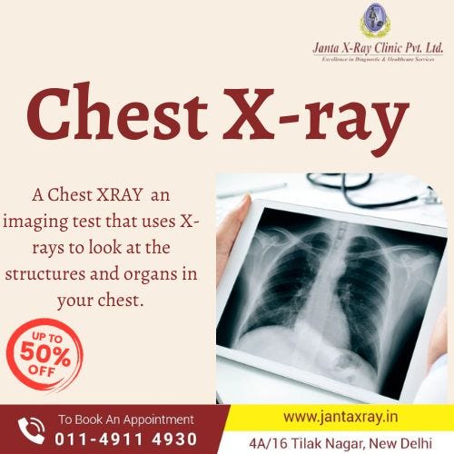 MRI Scans Everything You Need to Know by Janta X Ray Medium