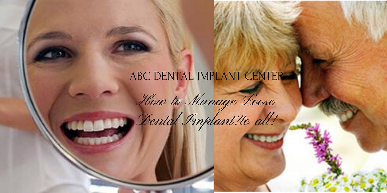 Get all on 4 Dental Implants on same Day in Las Vegas by Dr. Kevin