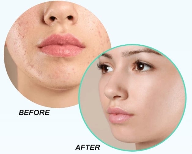 Fast Burn Extreme is an effective fat burner designed