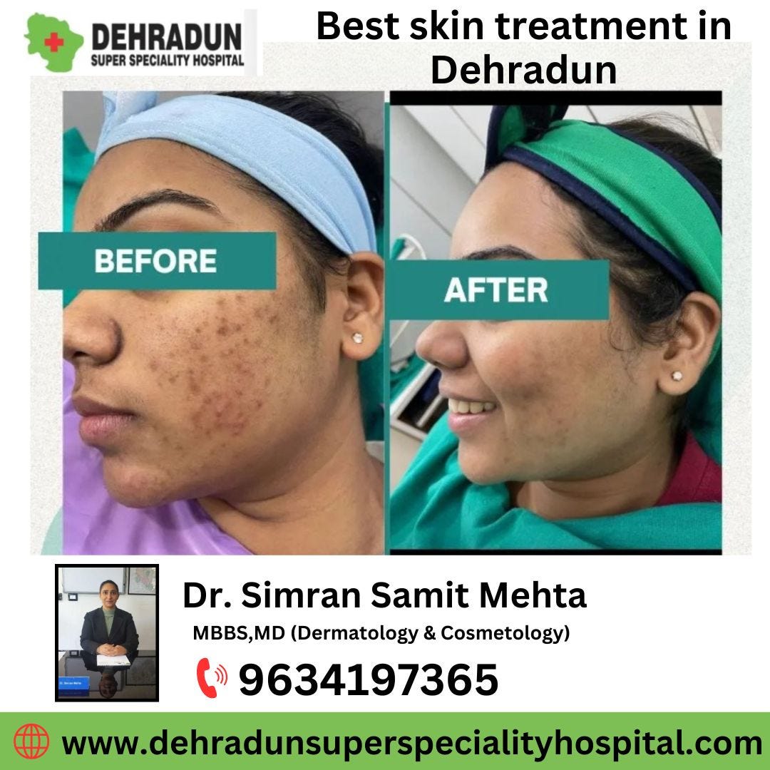 Elevate Your Living Space with Professional Cleaning Services in Milton