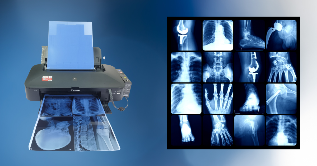 X-ray Control Panel: Navigating the Hub of Radiographic Precision | by ...