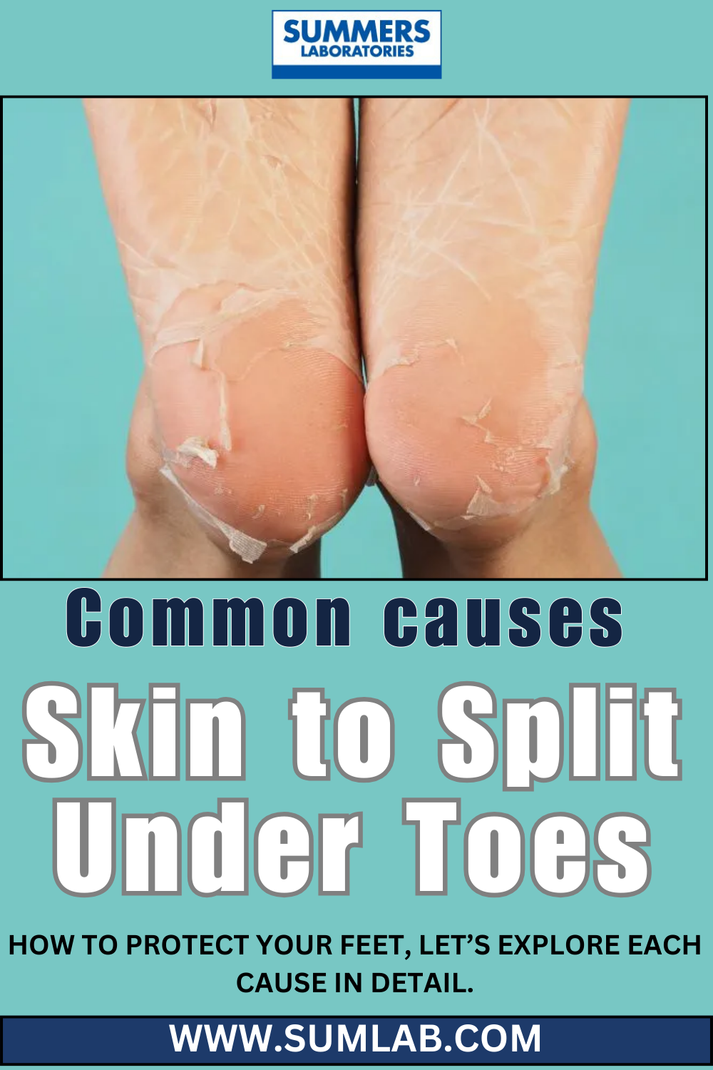 Why are my hands so dry even when I moisturize? Summerslaboratories