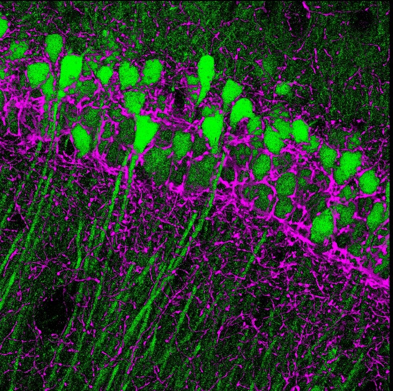 The CB1 cannabinoid receptor (magenta) expressed by basket cell axons and surrounding the hippocampal CA1 pyramidal cells (green).