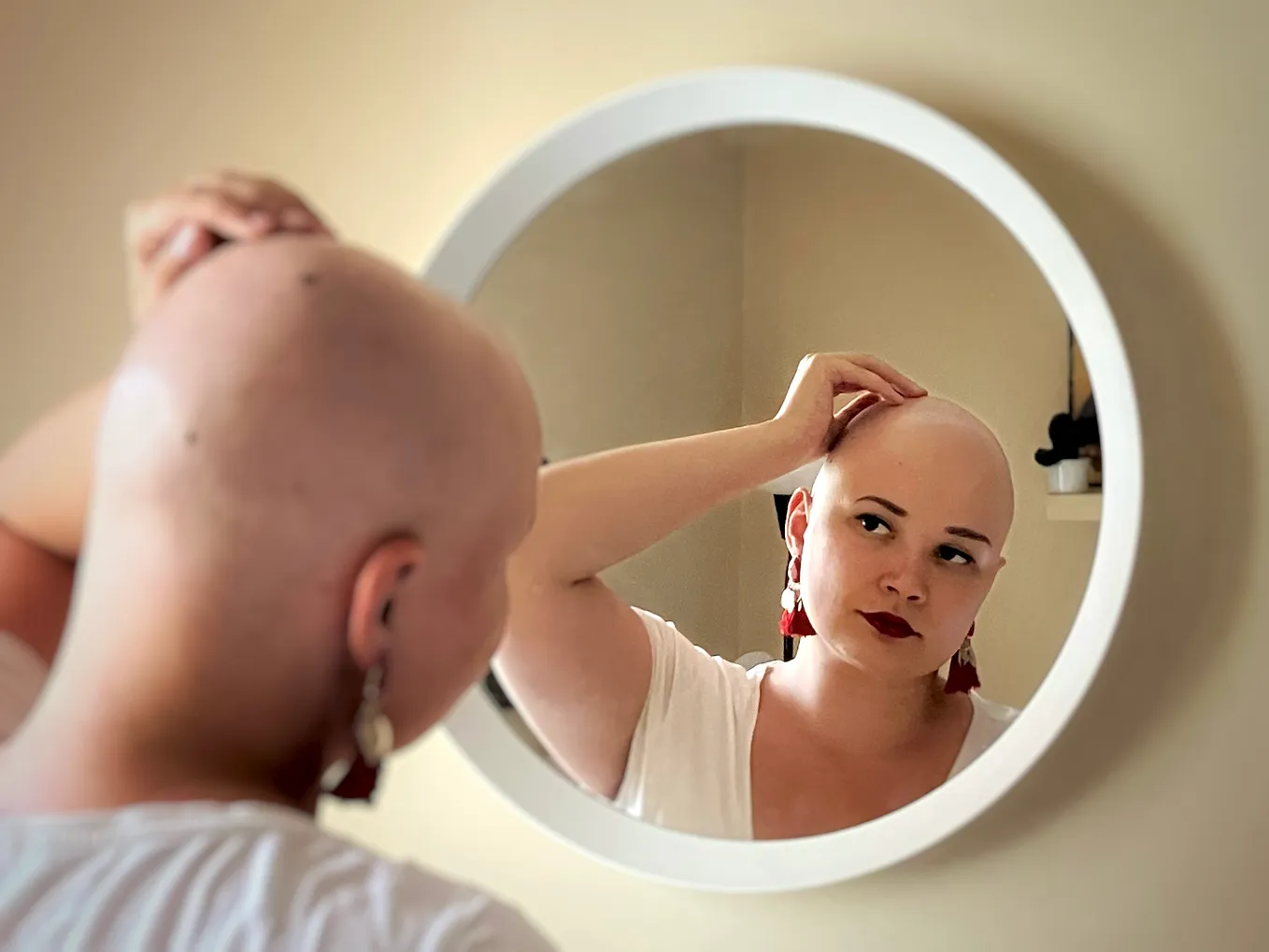 “It’s not just hair”: 3 women share their experience with hair loss