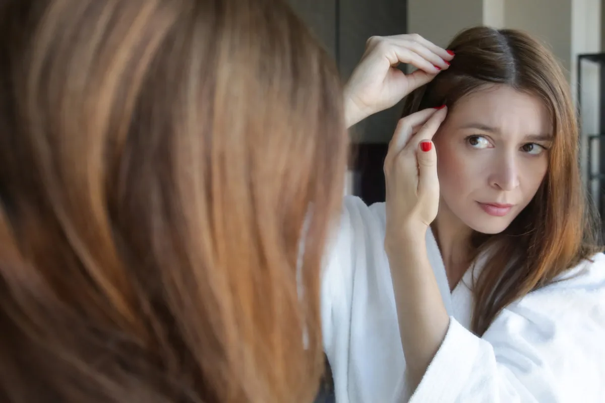 What Exactly is Dandruff and What Causes it?