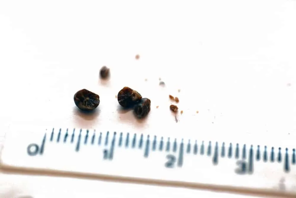 How Do You Treat The Different Sizes Of Kidney Stones Differently?