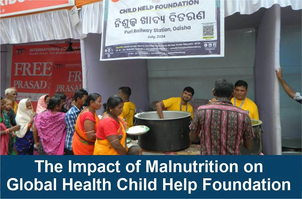 The Impact of Malnutrition on Global Health